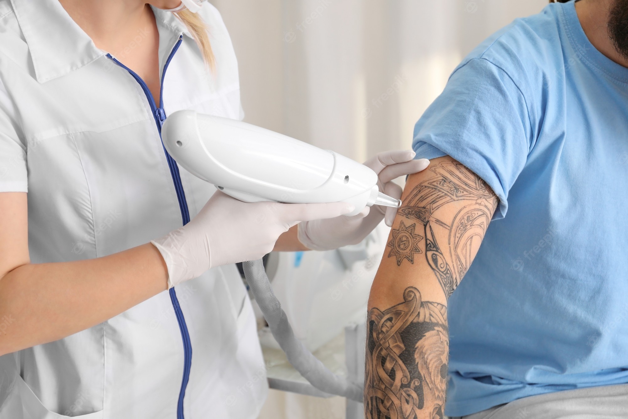 Tattoo Removal - Broward Dermatology