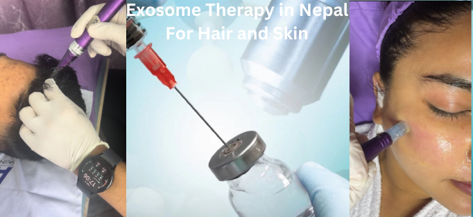 Exosome Treatment therapy in nepal