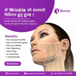 HIFU Treatment in Nepal - benefits