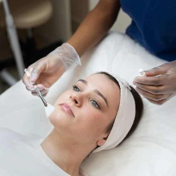 Chemical Peel in nepal