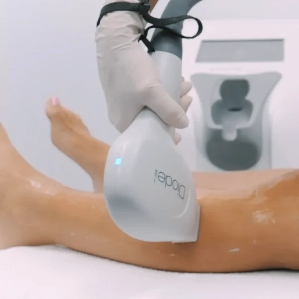 LASER HAIR REMOVAL in nepal