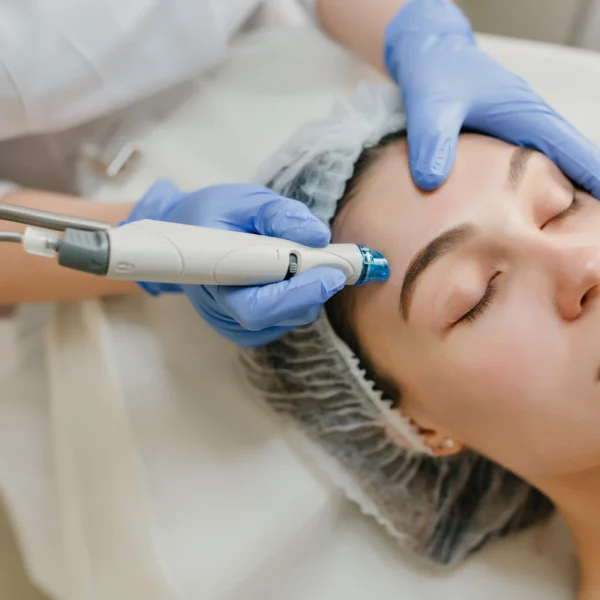 Hydra Facial Treatment In Nepal Procedures and Cost - HydraFacial Suction and Infusion