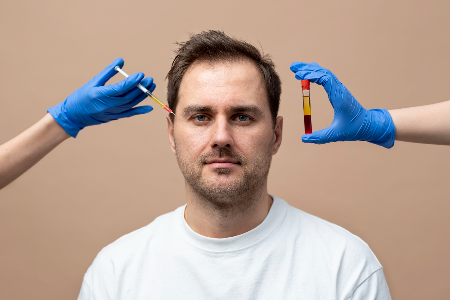 PRP Hair Treatment in Nepal PRP Therapy for male