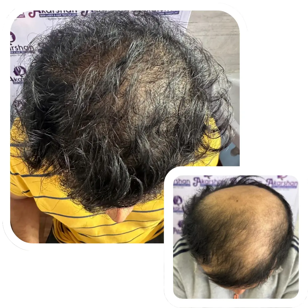 ht website before and after (1) (1)