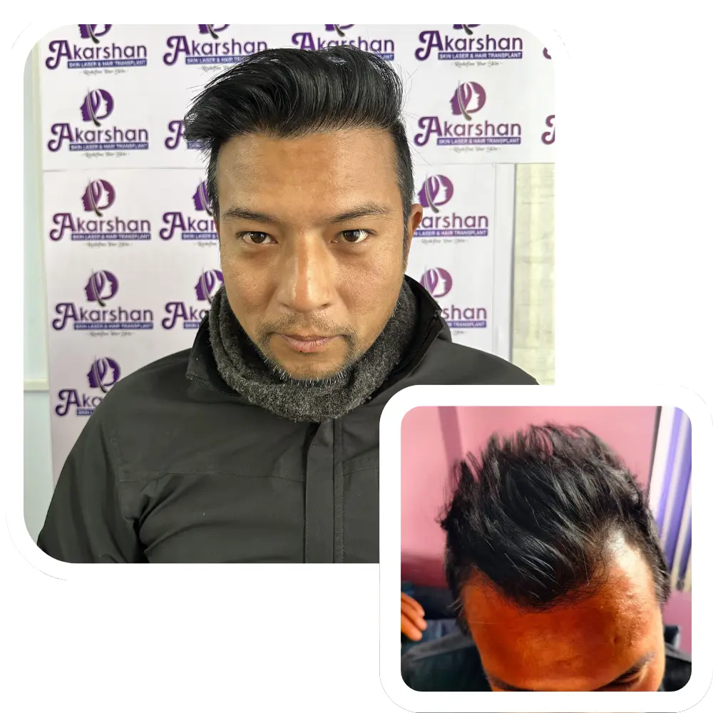 ht website before and after (1)