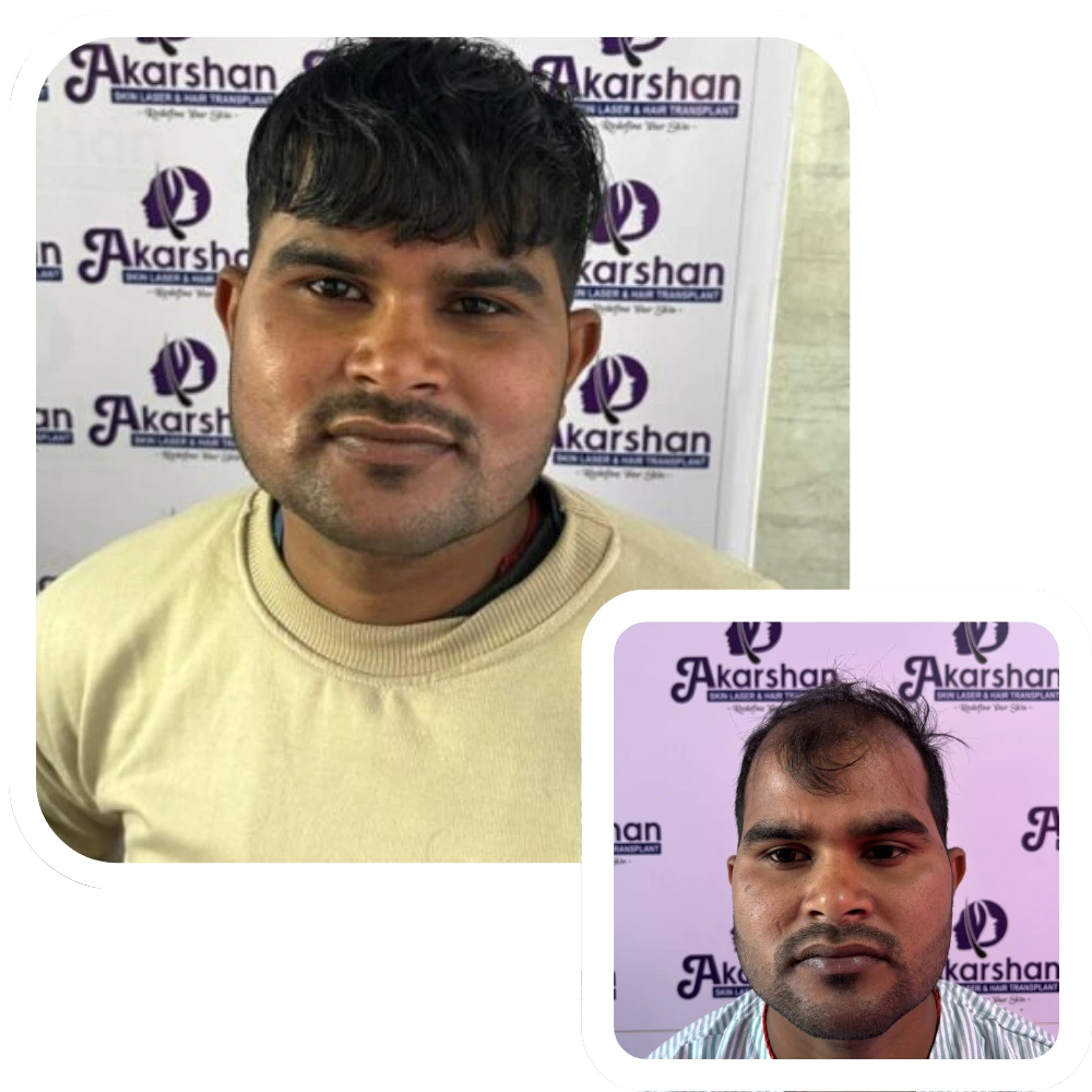 ht website before and after (2) (1)