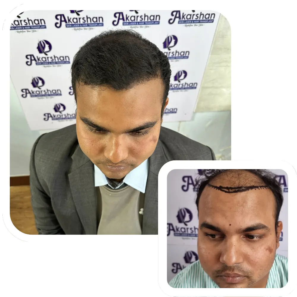 ht website before and after (2)
