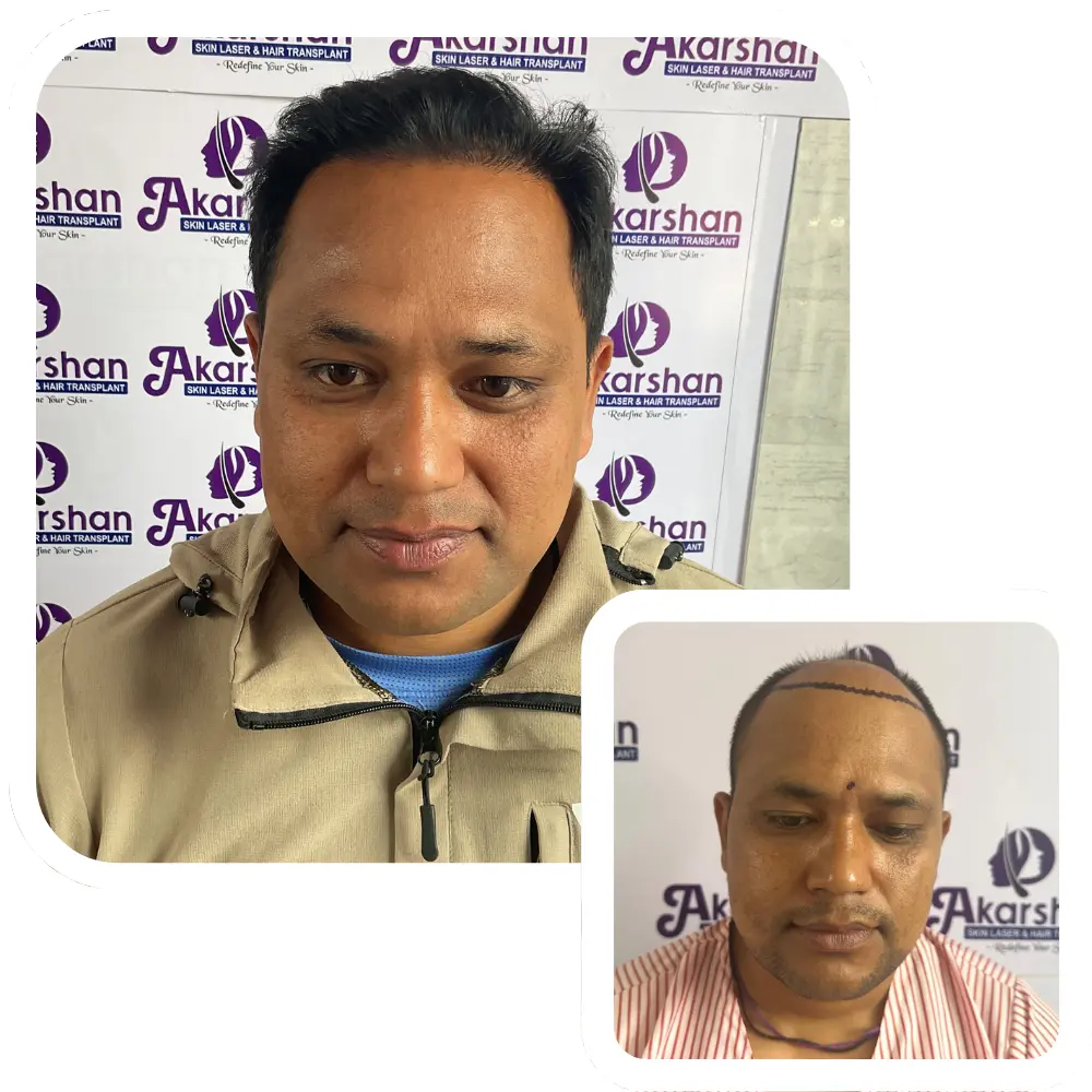 ht website before and after (3)