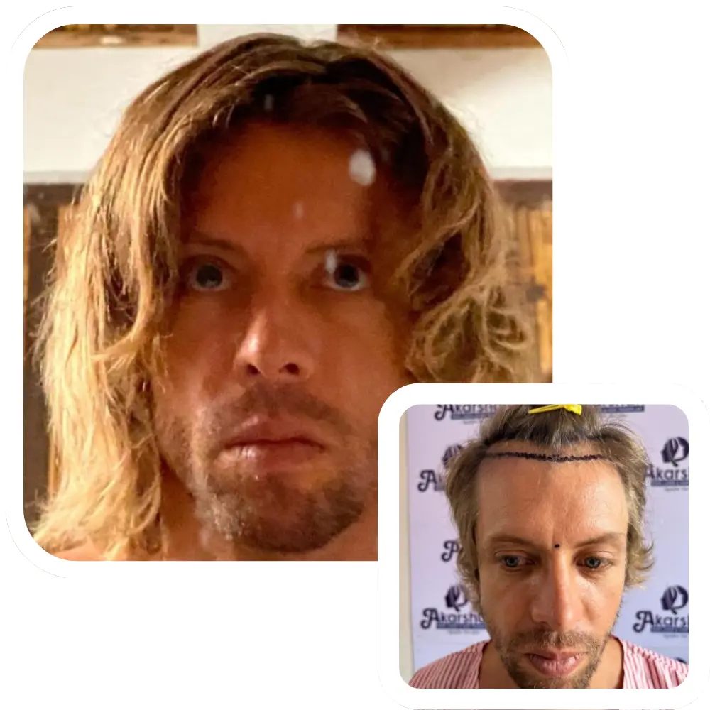 ht website before and after (4)