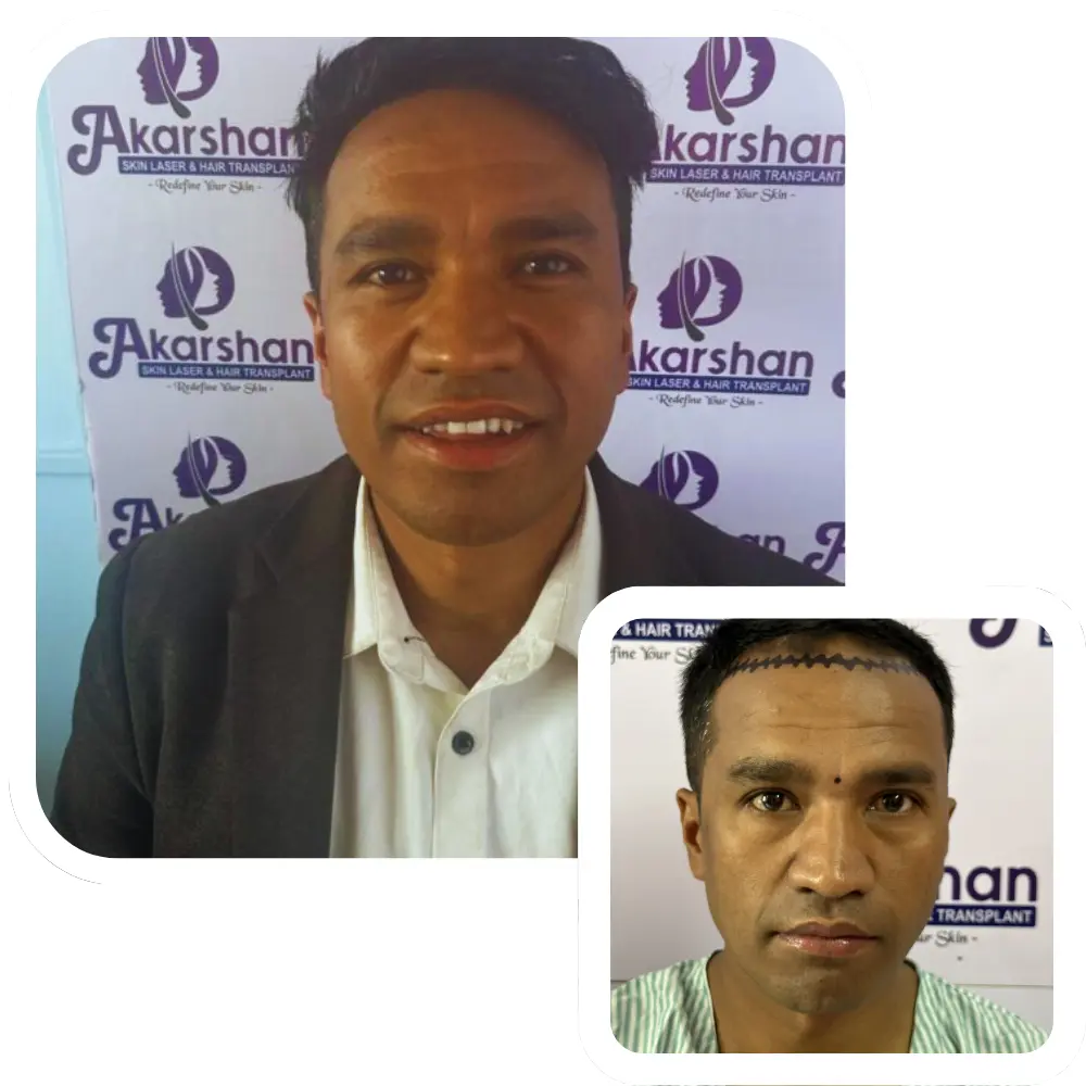 ht website before and after (5)