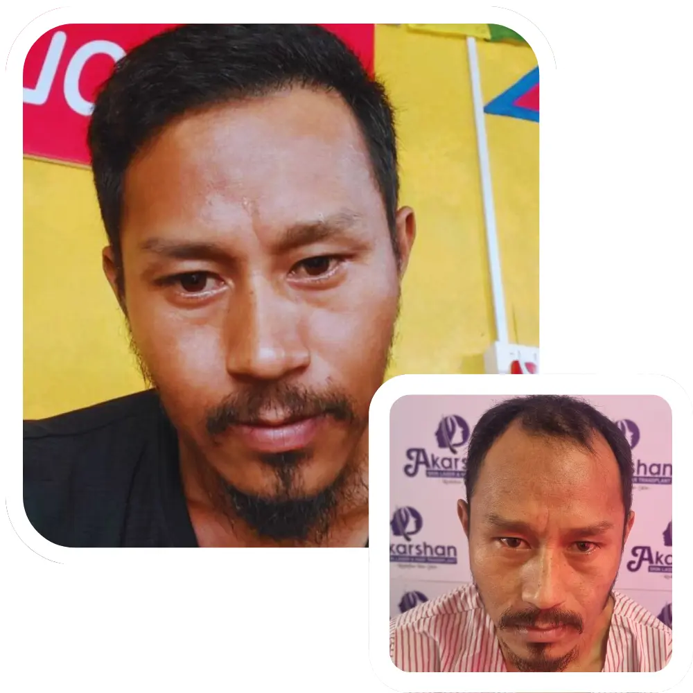 ht website before and after (6)