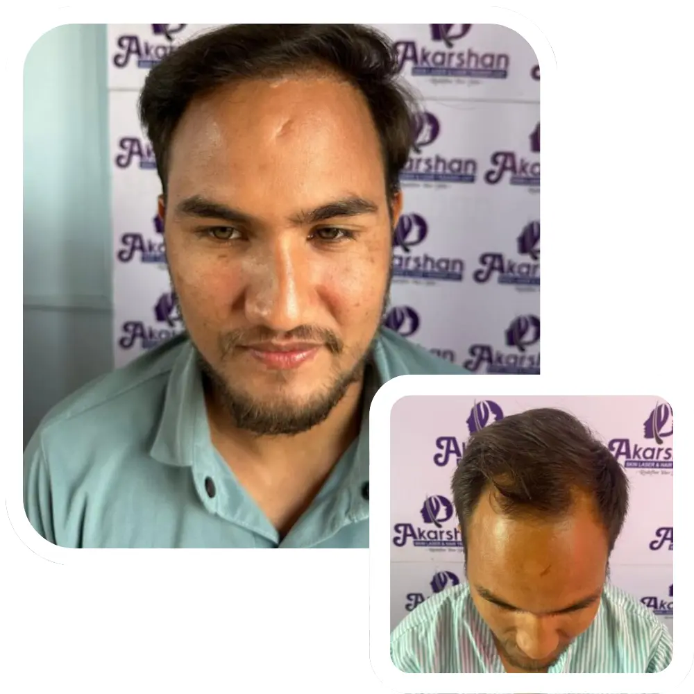ht website before and after (7)
