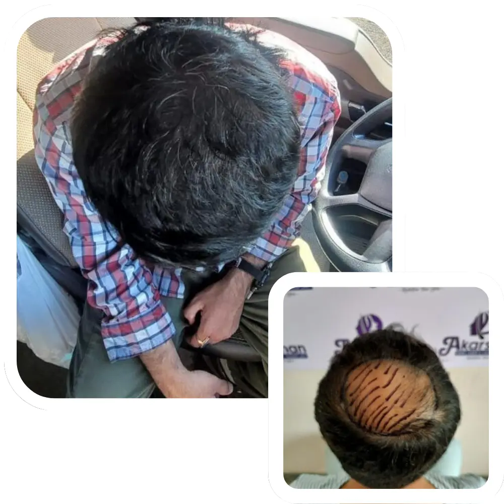 ht website before and after crown area (1)