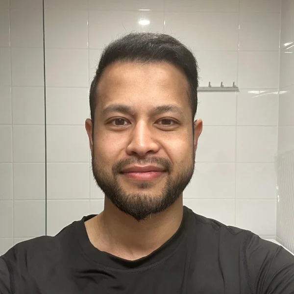 nicolas hair transplant result after 12 months 4500 graft dht