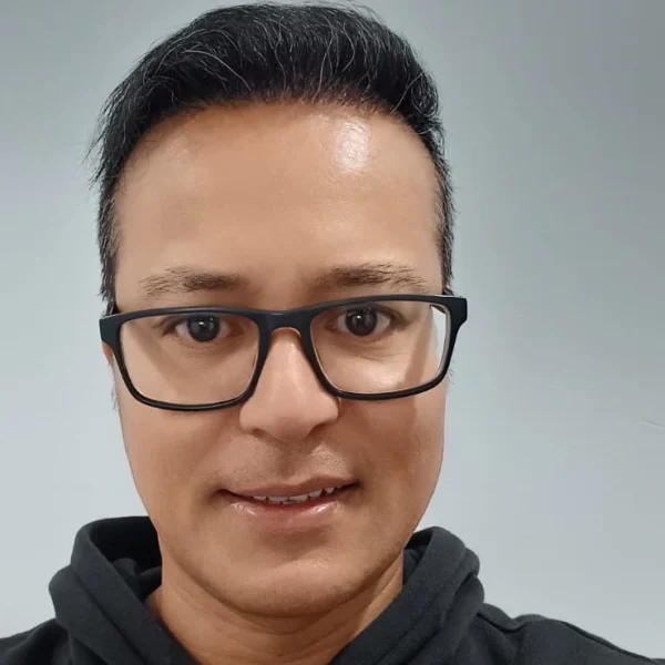 radhakrishna hair transplant result 12 months 3500 graft dht