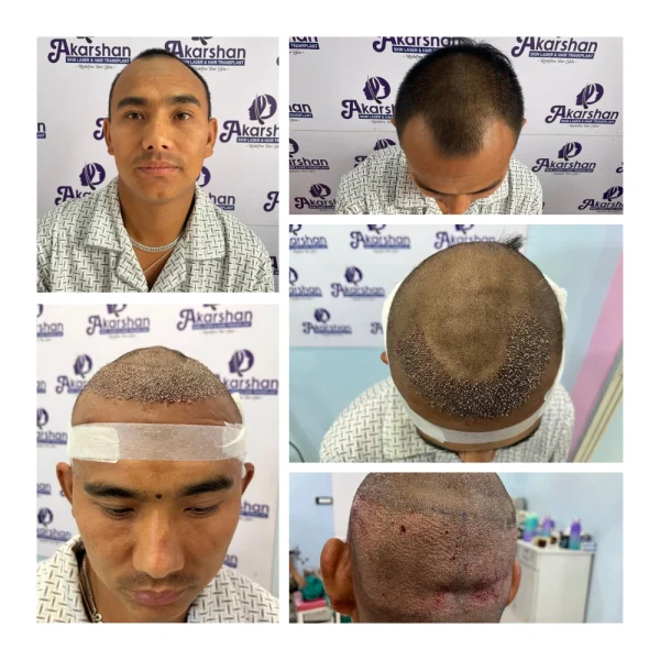 salikram pokhrel 2600 fue