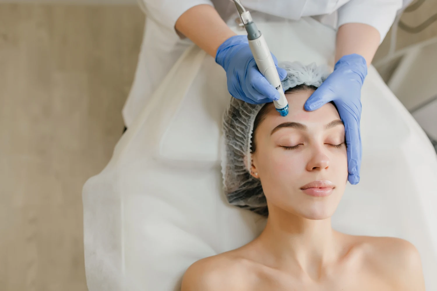 Microneedling treatment in nepal for female