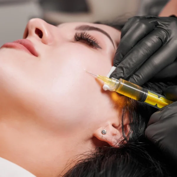 PDRN treatment in Nepal for female